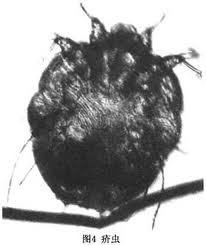 疥虫检查法_360百科