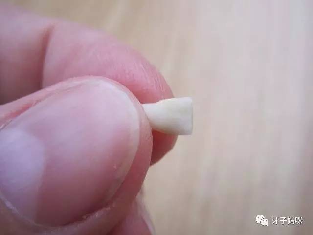 这两种药一起用会死+小孩掉落的乳牙别丢:可救自己一命 - 满园春色 - 满园春色 医生呼吁小孩掉落的乳牙别再丢掉,必要时可救自己一命! - 武汉老徐 - 武汉老徐的博客