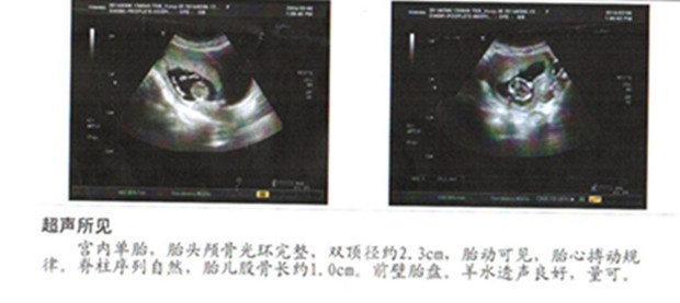 t0127ecf80e6a4ba726.jpg