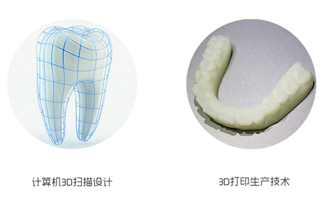 牙齿矫正迎来3d打印技术