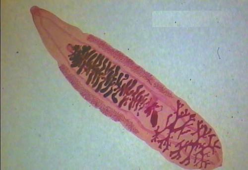 哪些寄生虫会寄生在人体里